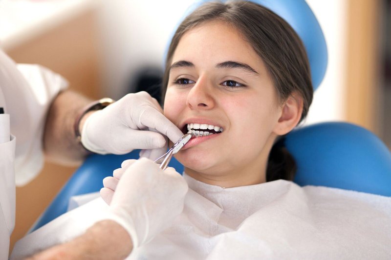 Top 4 Reasons Kids Get Dental Veneers| Tower Hill Dental Blog