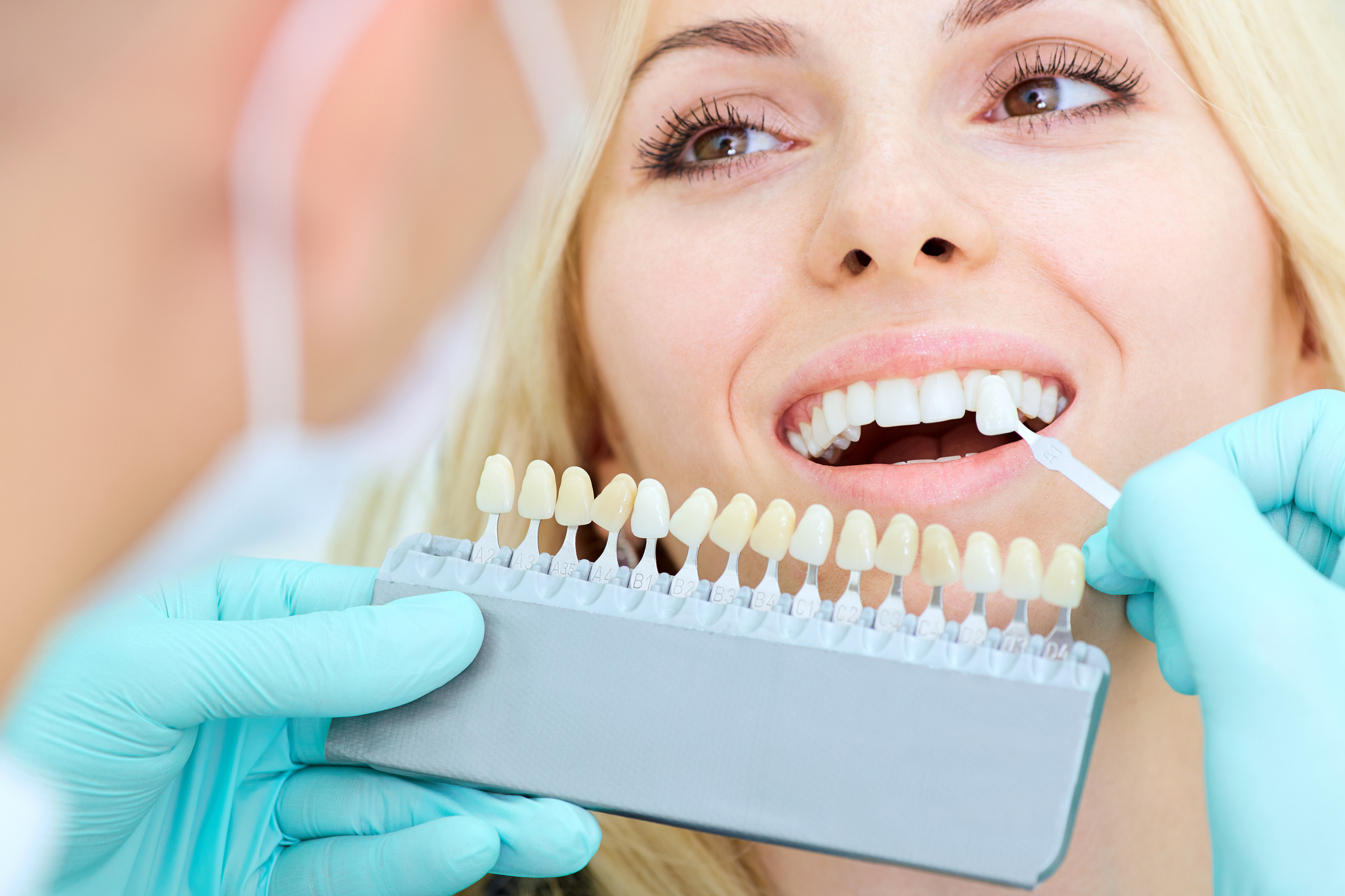 Dental Implants Richmond Hill